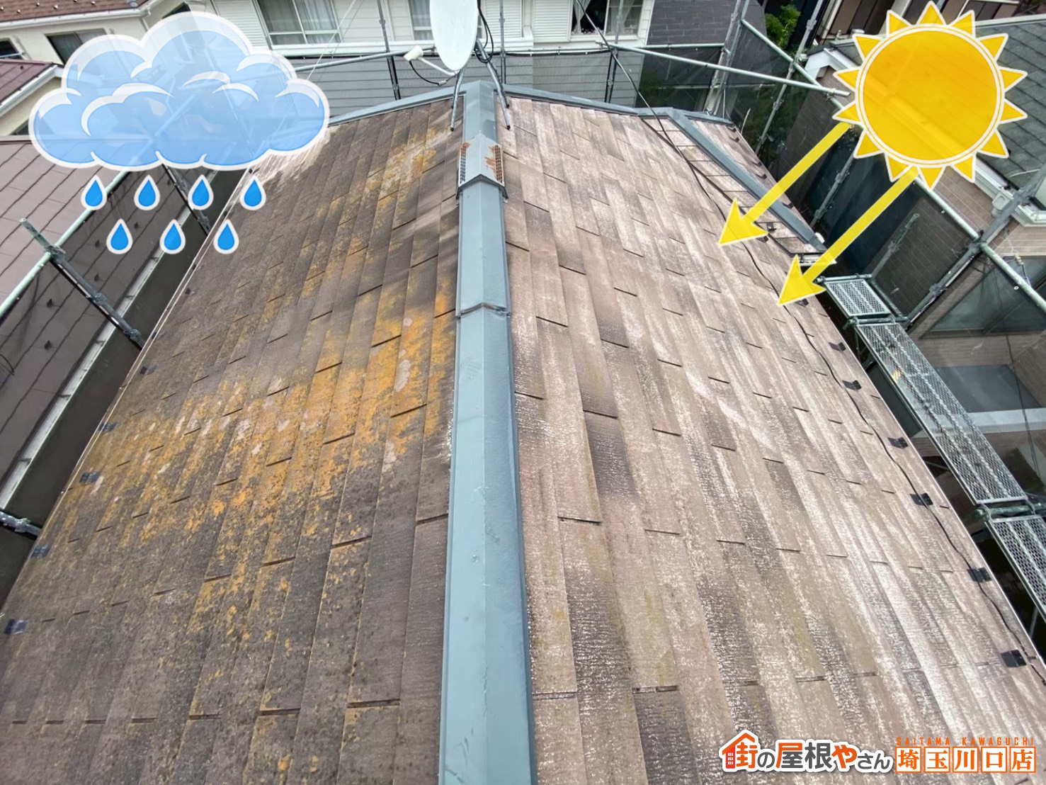 症状の違い